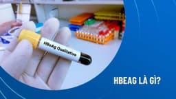 Xét nghiệm HBeAg là gì?