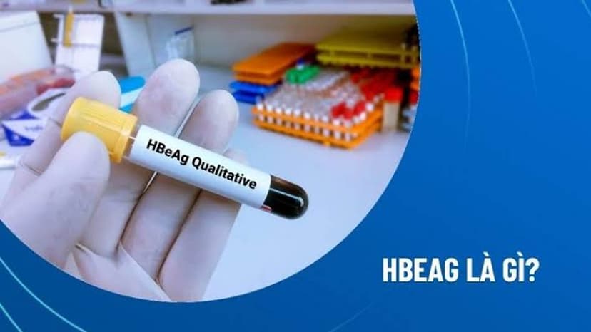 Xét nghiệm HBeAg là gì?