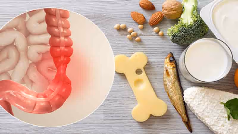 Chế độ ăn phù hợp giúp người bị hội chứng ruột kích thích kiểm soát triệu chứng tốt hơn
