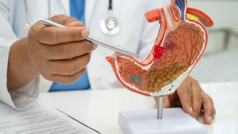 Viêm loét bờ cong nhỏ dạ dày có nguy hiểm không?