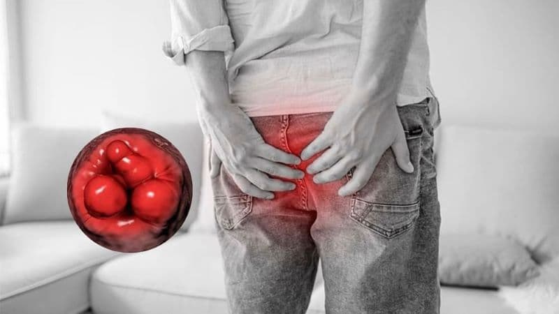Mức độ nguy hiểm của lòi dom phụ thuộc vào tình trạng sa, triệu chứng đi kèm và nguyên nhân thực tế