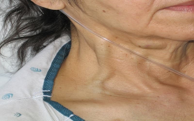 Nghiệm pháp phản hồi gan tĩnh mạch cổ đánh giá chức năng tim phải