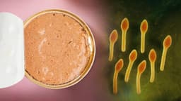 Nguyên nhân bị ngộ độc pate do đâu? Cần làm gì để bảo vệ sức khỏe?