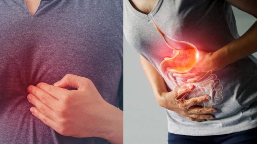 Đau thượng vị là do đâu? Nguyên nhân gây đau và cách xử lý