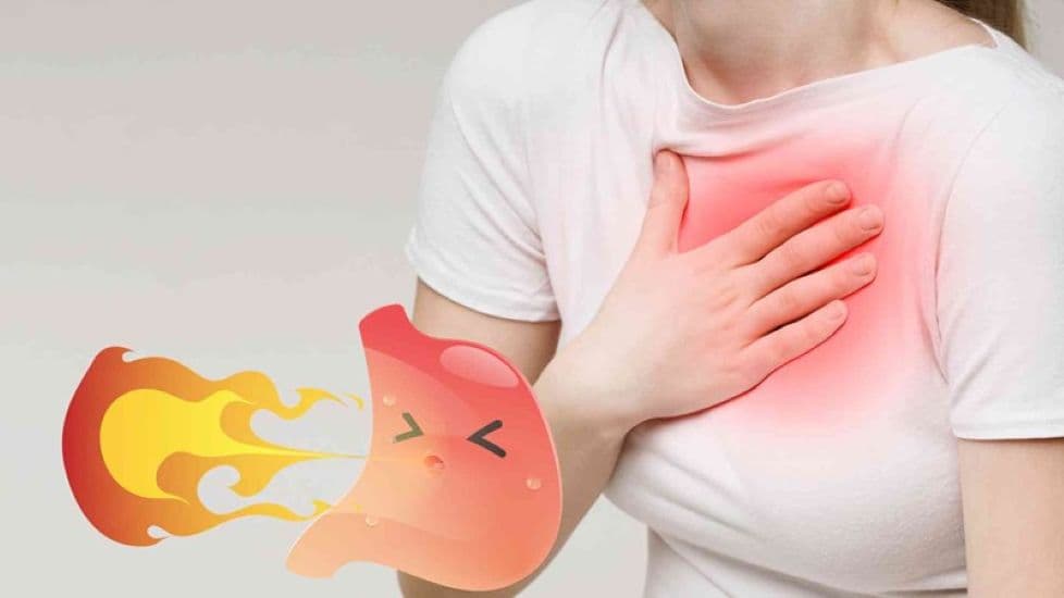 Các nguyên nhân trào ngược dạ dày