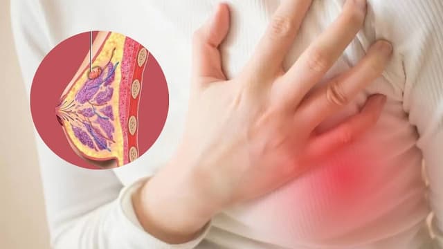 Nhân xơ tuyến vú có nguy hiểm không?