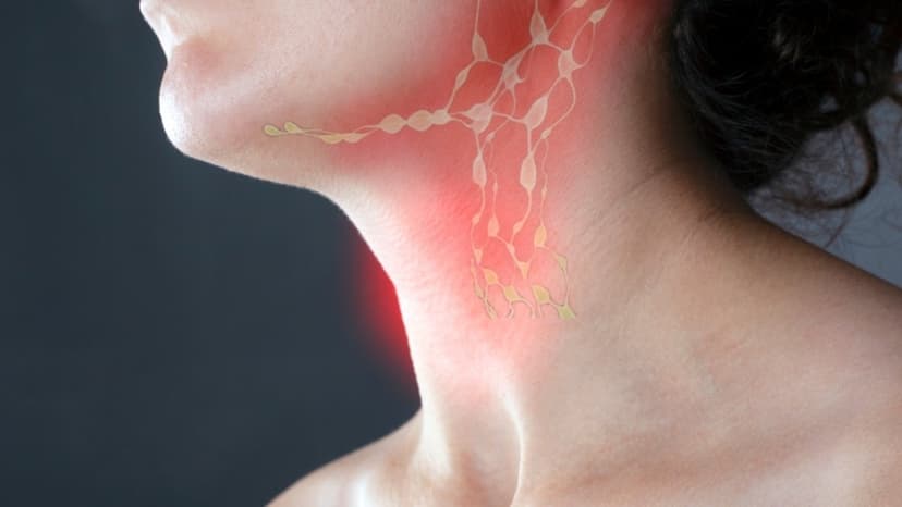 Bị nổi hạch ở cổ lâu ngày không đau có nguy hiểm không?