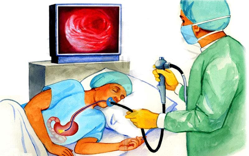 Nội soi tiêu hóa giúp chẩn đoán viêm loét dạ dày