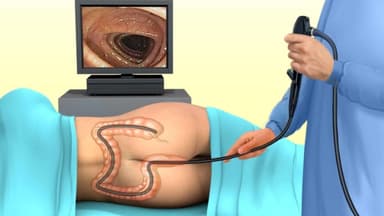 Nội soi đại tràng không gây mê có đau không? Quy trình thực hiện như thế nào?