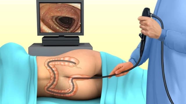 Nội soi đại tràng không gây mê có đau không? Quy trình thực hiện như thế nào?