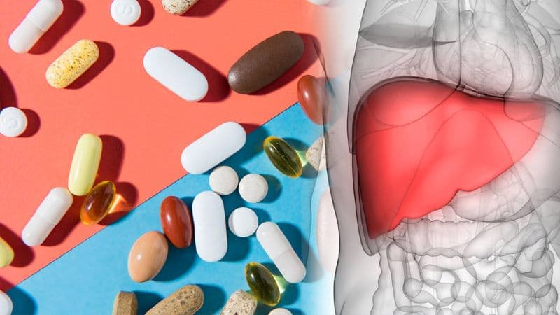 Không phải trường hợp vôi hóa gan nào cũng cần điều trị