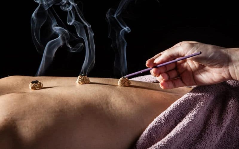 Phương pháp điều trị cứu ngải trong y học cổ truyền