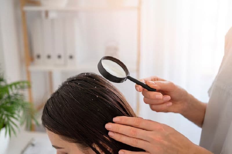 Nếu tình trạng rụng tóc kéo dài hoặc rụng nhiều, bác sĩ da liễu có thể cân nhắc xét nghiệm để tìm các nguyên nhân