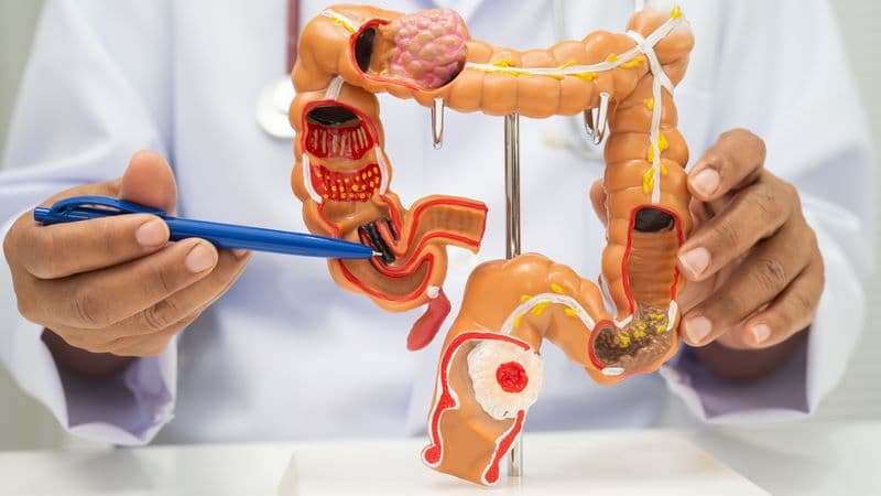 Tiêu hóa ở ruột già chủ yếu không phải là quá trình phân giải thức ăn mạnh như ở ruột non