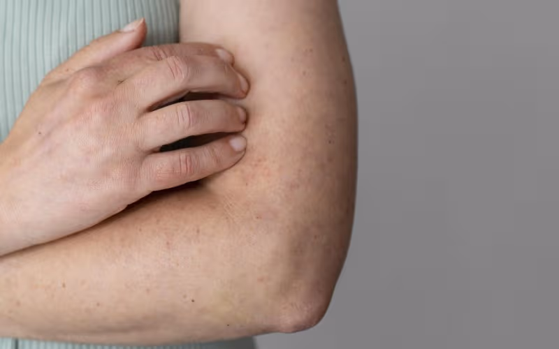 Sẩn ngứa do gan do chức năng gan bị suy giảm