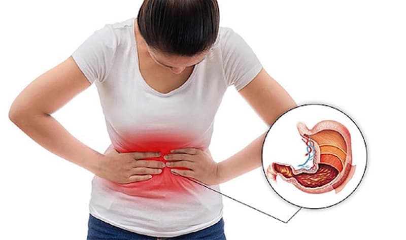 Thủng dạ dày có nguy cơ tử vong cao