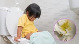 Trẻ 2 tuổi đi ngoài ra nước màu vàng có nguy hiểm không?