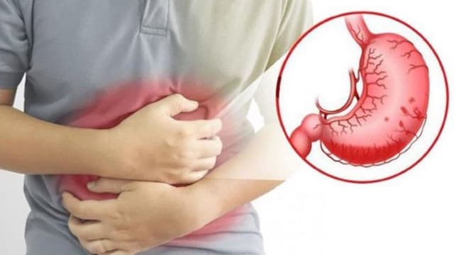 Triệu chứng dạ dày biểu hiện ra sao? Đâu là biểu hiện nguy hiểm cần chú ý?