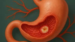 Nhận biết triệu chứng viêm loét dạ dày như thế nào?
