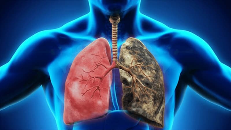 Ung thư phổi ăn được hải sản nhưng cần chế biến phù hợp