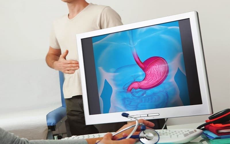 Điều trị vi khuẩn HP cần đúng phác đồ