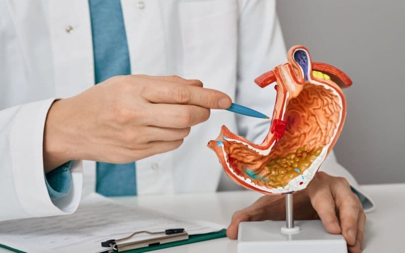 Dạ dày nằm chủ yếu ở bên trái và có phần nằm vùng trung tâm phía trên của ổ bụng