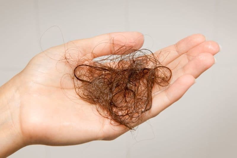 Viêm gan B có bị rụng tóc không là thắc mắc của nhiều người