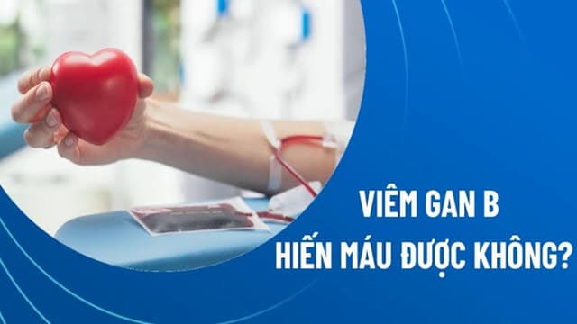 Viêm gan B có hiến máu được không? Khi nào không nên hiến máu?