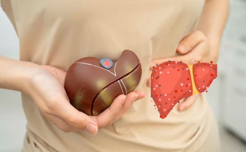 Tái hoạt viêm gan B có thể gây đợt bùng phát bệnh nghiêm trọng, thậm chí dẫn đến tử vong