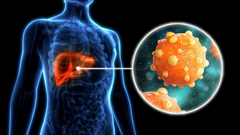 Viêm gan B mạn tính tiến triển là tình trạng nhiễm virus viêm gan B (HBV) kéo dài