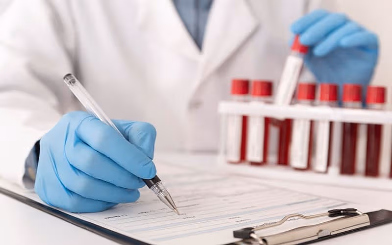 Xét nghiệm bilirubin giúp đánh giá nguyên nhân gây vàng da