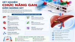 Xét nghiệm chức năng gan gồm những gì? Giải đáp các thắc mắc thường gặp