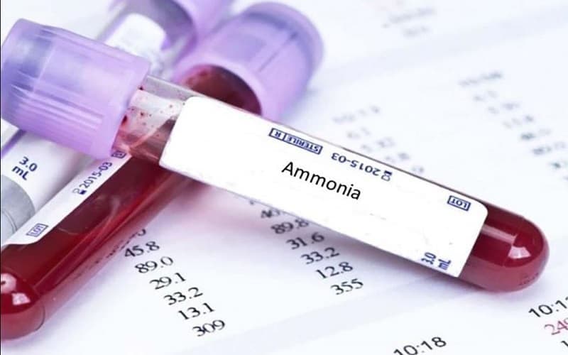 Amoniac máu tăng có thể gặp khi chức năng gan suy giảm nghiêm trọng