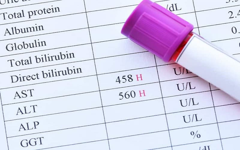 Xét nghiệm men gan giúp đánh giá tình trạng tổn thương tế bào gan thông qua các chỉ số