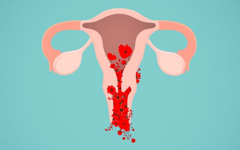 Bảng giá xoắn polyp cổ tử cung cần được xem theo tổng danh mục dịch vụ thay vì chỉ nhìn vào giá kỹ thuật.