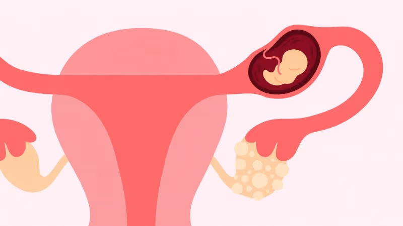 Theo dõi sát beta-hCG và tái khám định kỳ giúp đánh giá diễn tiến của thai ngoài tử cung.