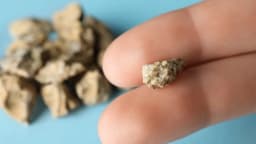 Sỏi thận 6mm ảnh hưởng ra sao? Khi nào có thể gây tắc nghẽn?