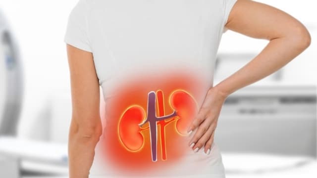 Sỏi bàng quang là gì? Nhận biết dấu hiệu, biến chứng và cách điều trị