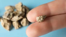 Sỏi niệu đạo: Nhận biết dấu hiệu, mức độ ảnh hưởng và cách điều trị