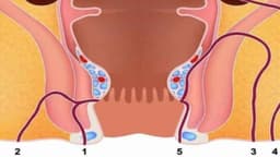 Rò hậu môn phức tạp: Dấu hiệu, chẩn đoán và hướng điều trị