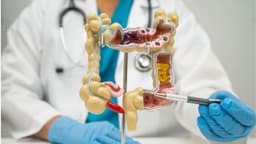 Áp xe ruột thừa là gì? Dấu hiệu nhận biết, nguyên nhân và cách điều trị