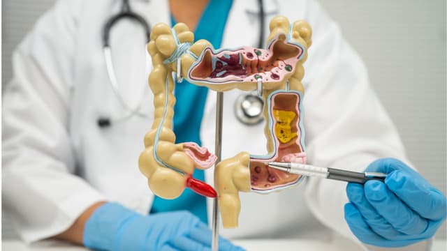 Áp xe ruột thừa là gì? Dấu hiệu nhận biết, nguyên nhân và cách điều trị