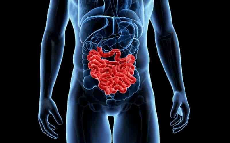 Loét ruột non ảnh hưởng đến chức năng tiêu hóa
