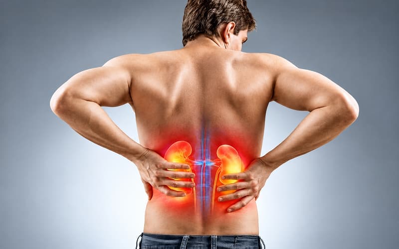 Nguy cơ viêm thận khi bị sỏi bàng quang
