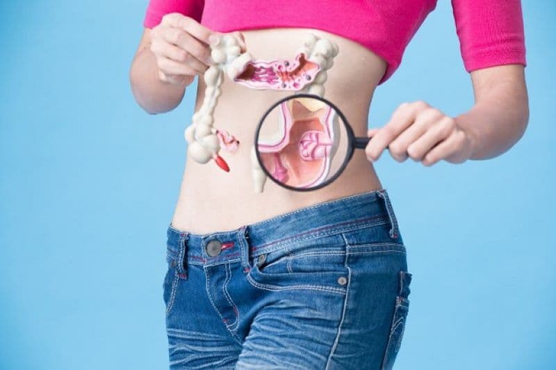 Viêm đại tràng vi thể là một tình trạng viêm mãn tính xảy ra ở niêm mạc đại tràng