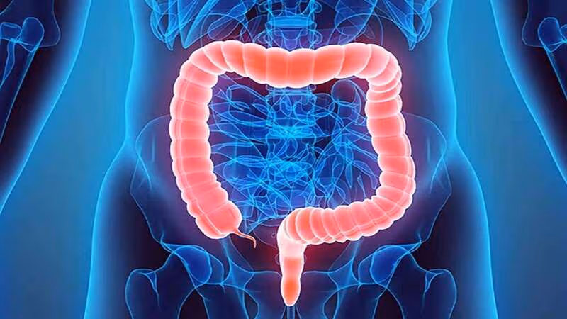 Điều trị hội chứng ruột kích thích cần được cá thể hóa và có thể phải phối hợp nhiều biện pháp
