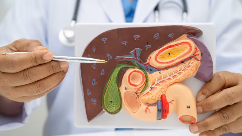 Cách chữa viêm túi mật mạn phụ thuộc vào nguyên nhân, mức độ tổn thương, triệu chứng và tình trạng sỏi mật đi kèm