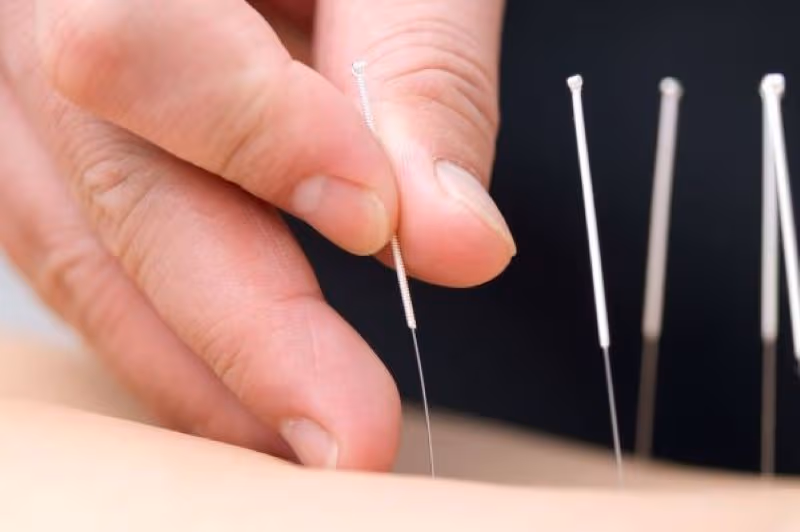 Châm cứu không phải phương pháp có thể chữa khỏi hoàn toàn 