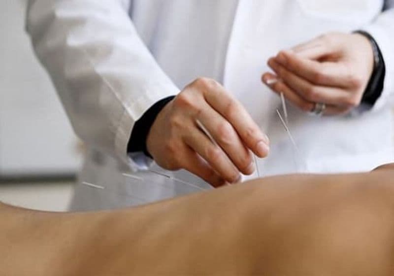 Châm cứu có nhiều lợi ích, giúp cải thiện cuộc sống sinh hoạt hàng ngày 