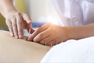 Châm cứu phục hồi sau tai biến có hiệu quả không?